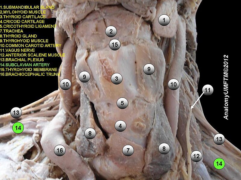 File:Slide13e.JPG