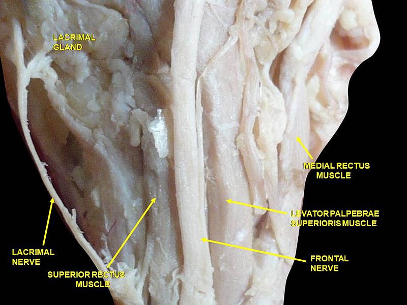 File:Slide3abab.JPG