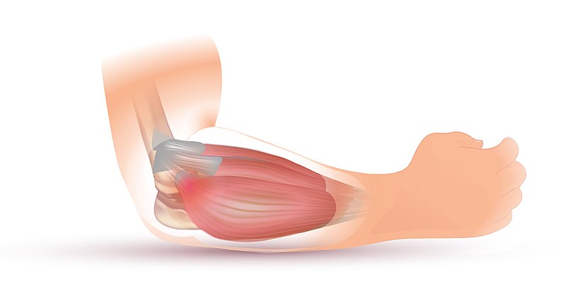 Picture of tennis elbow pain showing the tendons that connect to the outer elbow bone