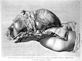 The anatomy of the human gravid uterus exhibited in figures. Wellcome L0003636.jpg