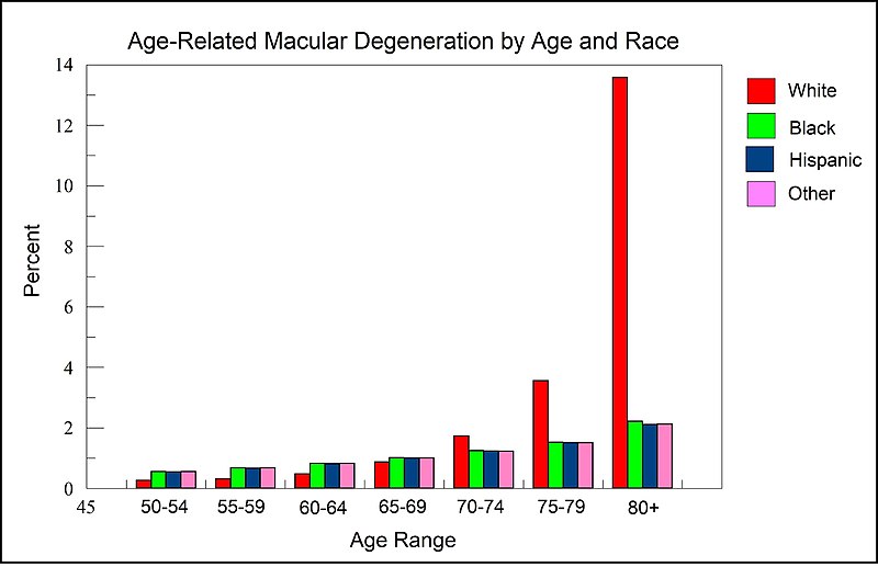 AMD by race and age from National Eye Institute data