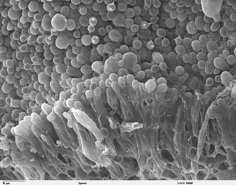 File:Agaricus bisporus spores SEM 1.jpg