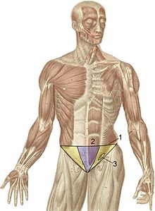 Inguinal Hernia - NIDDK