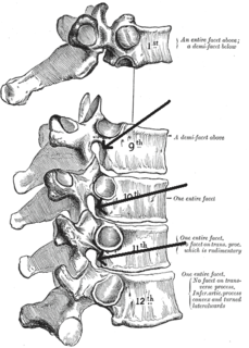 Intervertebral foramen Foramen between spinal vertebrae