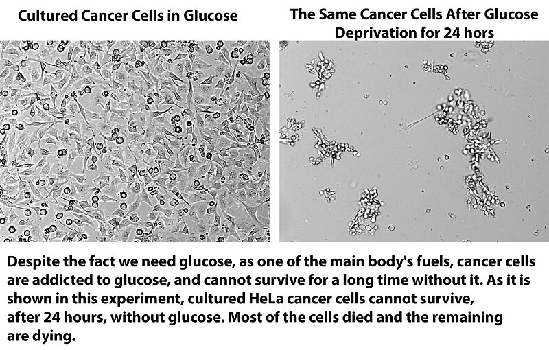 File:HeLa Cultured Cancer Cells Dying Without Glucose.jpg