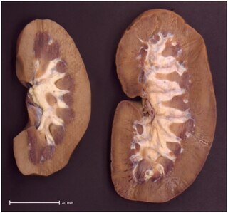 <span class="mw-page-title-main">Compensatory growth (organ)</span> Type of regenerative growth