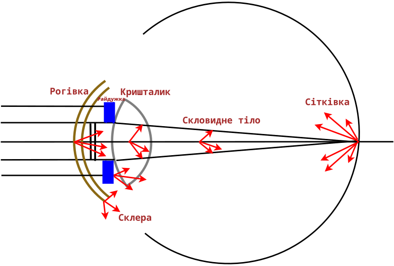 File:Light Scattering in the Human Eye.svg