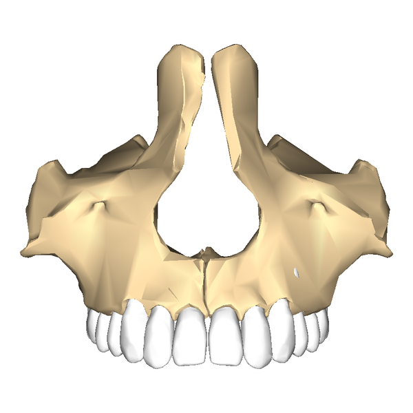 File:Maxilla close-up anterior.png