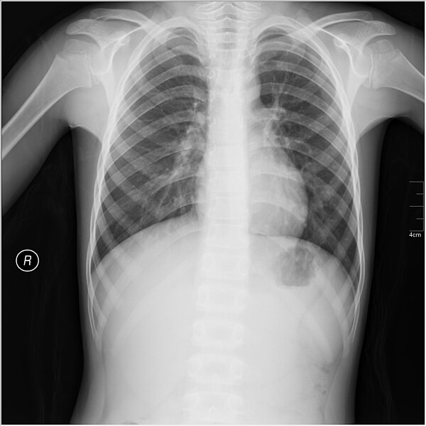 File:Medical X-Ray imaging BIT02 nevit.jpg