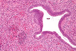 صورةٌ مجهرية تُظهر خلايا دم حمراء ذات أنوية (أسفل يسار الصورة)، وهي مكونٍ ضروري لتكون الدم خارج النخاع في سليلة بطانة الرحم. الصُورة بصبغة الهيماتوكسيلين واليوزين.