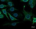 SK8-18-2 human derived cells, fluorescence microscopy (29942101073).jpg