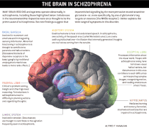 Schizophrenia brain large.gif