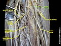 Arteria radiale