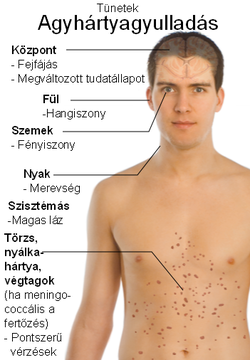 Koronavírus-fertőzés tünetei, kezelése, szövődményei és a koronavírus-mutációk - EgészségKalauz