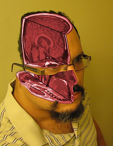 MRI self portrait by Tomas Diaz. The subject's MRI images incorporated into a picture of his head, to create a self portrait that not only showed the head but also what's really inside of it. National Jury's Choice Award International Runner-Up