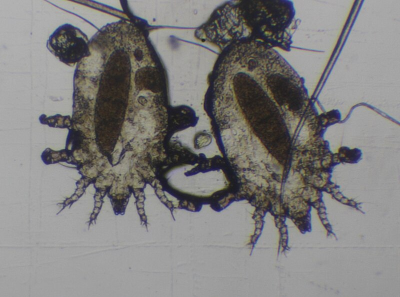 File:Дві самиці Myocoptes musculinus з яйцем в середині .jpg