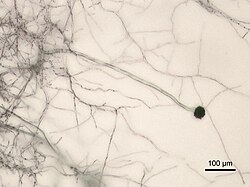 Aspergillus niger Micrograph.jpg