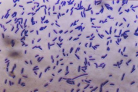 Палочки в мазке. Ruminococcus Albus бактерия. Синегнойная палочка по Граму. Ruminococcus flavefaciens. Синегнойная палочка микроскопия.