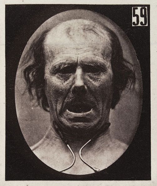 File:Experiments in physiology. Facial contraction. Wellcome L0040108.jpg