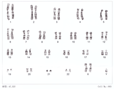 Human chromosomesXXY01.png