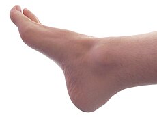 230px-Male_Right_Foot_1.jpg