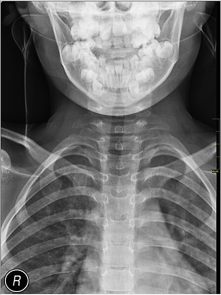 File:Medical X-Ray imaging VSL07 nevit.jpg