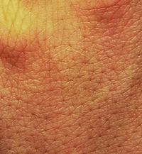 Human skin.jpg