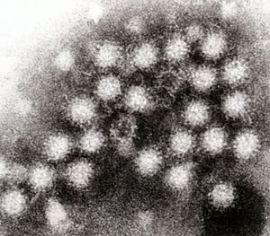 English: Norovirus particles