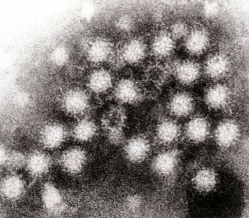 Norovirus 4