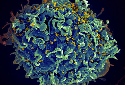 Hiv virus