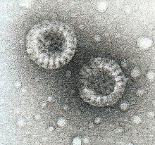 Description: Electron micrograph of two rotavirus particles that have been negatively stained with potassium phosphotungstate Rotaviruses.jpg