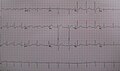 Pisipilt versioonist seisuga 18. september 2010, kell 08:59