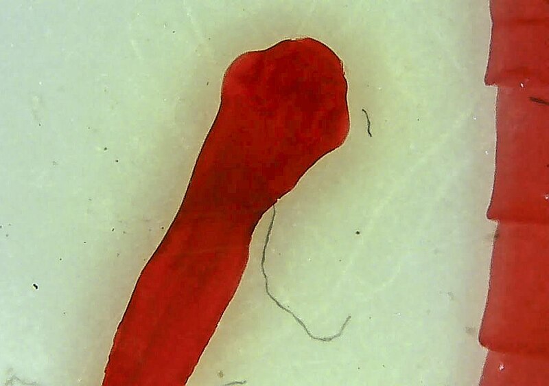 File:Tapeworm Scolex Taenia1.jpg