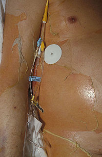 <span class="mw-page-title-main">Toxic epidermal necrolysis</span> Severe skin reaction