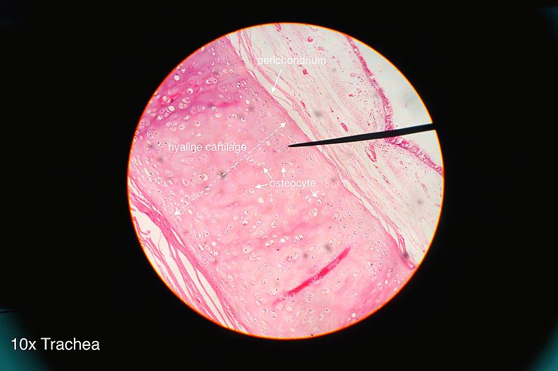 File:Trachea histology 2014.jpg