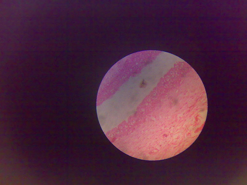 File:Transitional epithelium.jpg