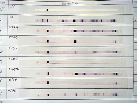 Western blot test results. The first two strips are a negative and a positive control, respectively. The others are actual tests.