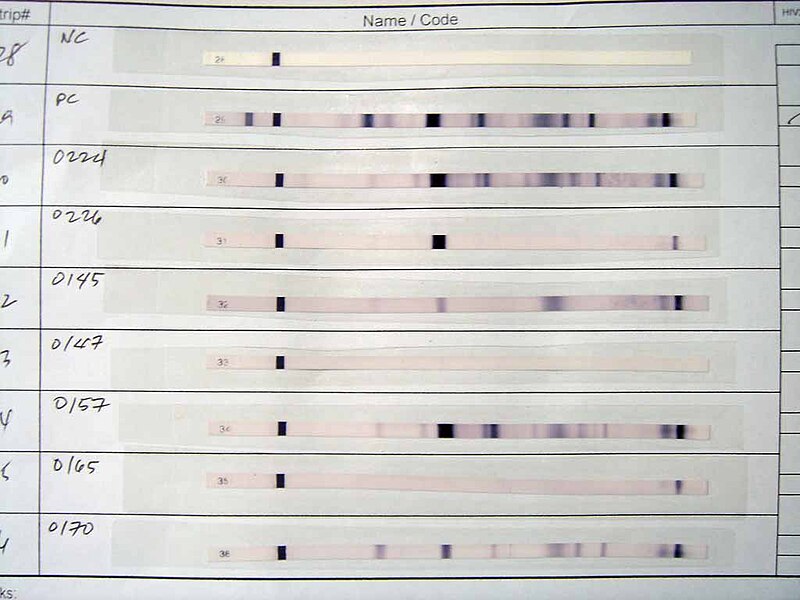 File:Western Blot results for HIV test.jpg