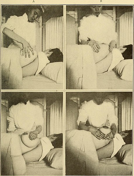 File:A nurse's handbook of obstetrics, for use in training-schools (1909) (14596058309).jpg