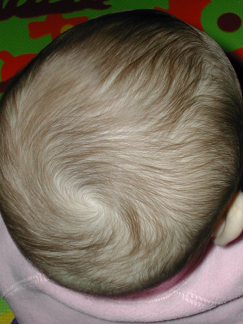 Hair whorl - Wikipedia
