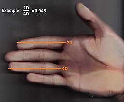The 2D:4D digit ratio is a common method to estimate fetal testosterone exposure Hand zur Abmessung 2D4D.jpg