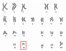 Human male karyotpe high resolution - Chromosome 20.png