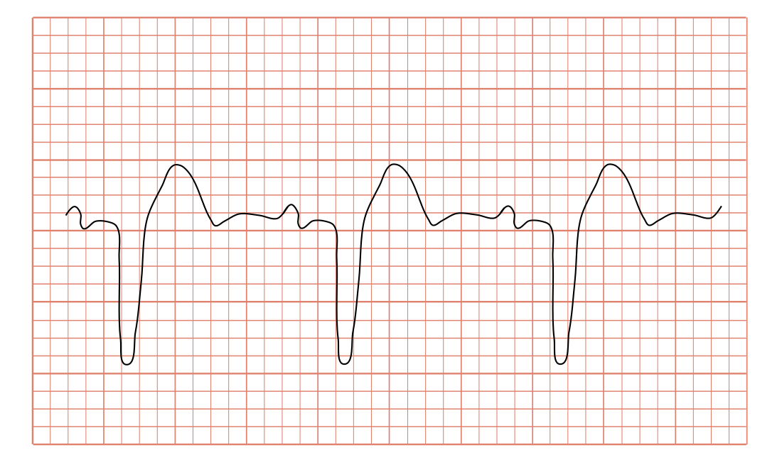 脚ブロック