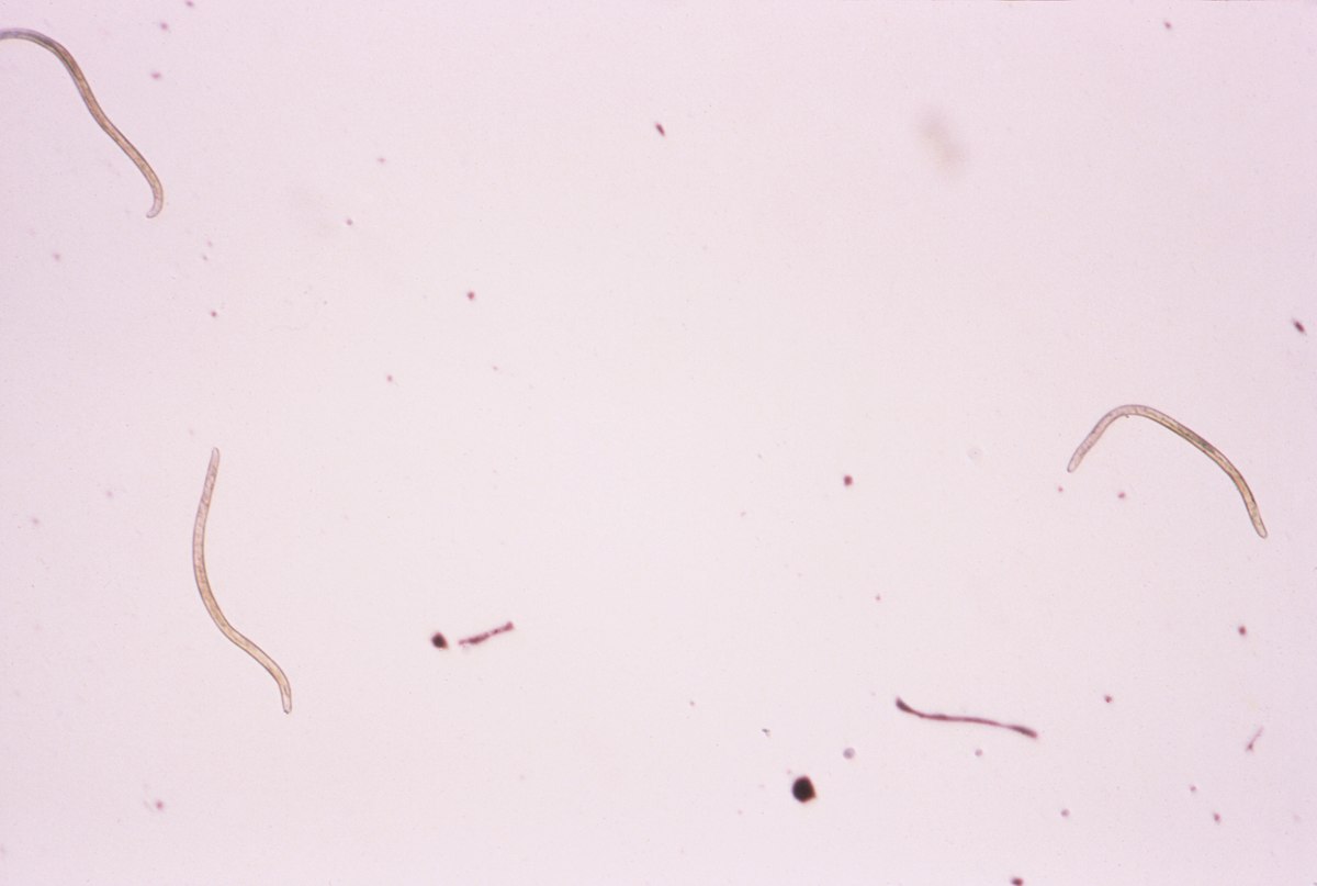 ismered giardiát baktériumok a torokban