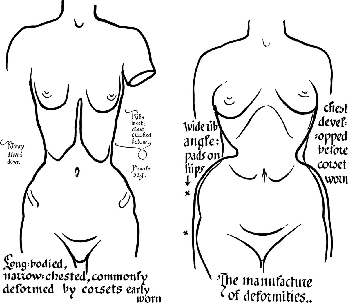 File:Toleration of the corset1028fig6-7.png - Wikimedia Commons