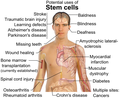 Hình xem trước của phiên bản lúc 04:48, ngày 27 tháng 4 năm 2009