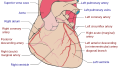 Download File:Coronary arteries.svg - Wikimedia Commons