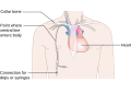 Miniatura wersji z 15:46, 30 lip 2014