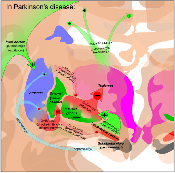 File:Basal ganglia in Parkinson's disease.png