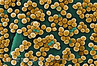 ภาพสี: กลุ่มแบคทีเรียทรงกลมที่เกาะกลุ่มกันเป็นรูปร่างคล้ายพวงองุ่น